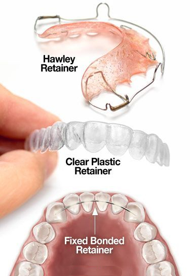 retainer options